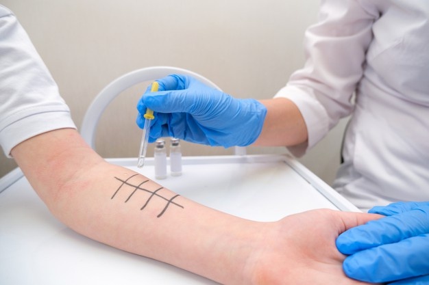 es Alergi Atau Skin Prick Test – Apa Yang Perlu Dipersiapkan?